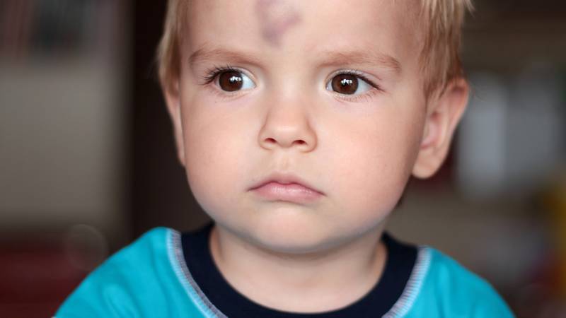 Je Kindje Heeft Zijn Hoofd Gestoten Wanneer Is Er Reden Tot Zorgen