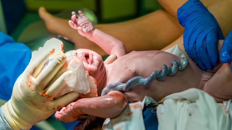 Lotusbevalling De Navelstreng Niet Doorknippen